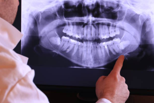 Best Emergency Dental Care for Broken or Chipped Teeth in Clinton, WI